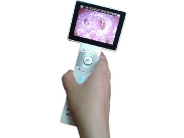 Η ψηφιακή μηχανή Magnifier τρίχας καμερών δερμάτων με το μίνι λιμένα USB διαβιβάζει τις εικόνες στο PC που επιδεικνύει τις εικόνες ταυτόχρονα