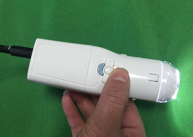 Κολπική κάμερα ψηφιακό ηλεκτρονικό Colposcope για να βρεί την ασθένεια του τραχήλου Eealier