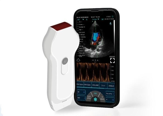 Προσωπικός σαρωτής υπερήχων Linear+Cardiac Probe 2,2MHz Mobile Format DICOM