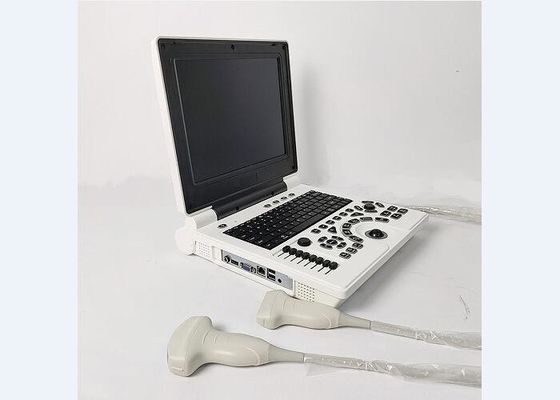 Φορητός φορητός φορητός φορητός υπολογιστής χειρός σαρωτής κύστης έγχρωμο σύστημα υπερήχων με 2 υποδοχές ανιχνευτή