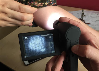 Τηλεοπτικό μικροσκόπιο φορητό Dermatoscope δερμάτων με την περιστρέψιμη επίδειξη χρώματος 3 ίντσας TFT