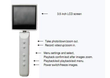 Φορητό οφθαλμοσκόπιο ωτοσκοπίων βιντεοκάμερων διαγνωστικό τηλεοπτικό ψηφιακό με την προαιρετική WIFI USB σύνδεση παραγωγής