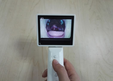 Το φορητό τηλεοπτικό οφθαλμοσκόπιο ωτοσκοπίων σύνδεσης USB ή WIFI έθεσε 3 φακούς προαιρετικούς