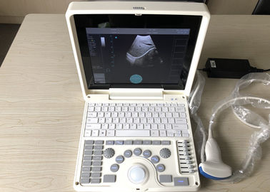 Φορητό ευφυές ζουμ 12 ανιχνευτών υπερήχου εγκυμοσύνης «LCD φορητό με τον κυρτό έλεγχο 3.5MHz