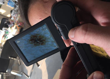 Τηλεοπτικός Dermatoscope ελεγκτής επιφάνειας δερμάτων συσκευών ανάλυσης USB δερμάτων μικροσκοπίων ψηφιακός με το όργανο ελέγχου 3 ίντσας