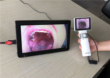 Φορητή ωτοσκοπίων κάμερα Dermatoscope λαιμού οφθαλμοσκοπίων τηλεοπτική με την παραγωγή καρτών SD για την κλινική