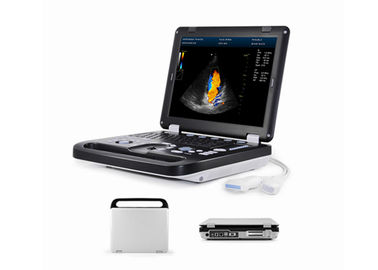 Υψηλός - μηχανή Doppler ποιοτικού 2$α πλήρης ψηφιακή χρώματος για τη δοκιμή εγκυμοσύνης με τον κυρτό έλεγχο