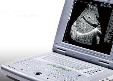 Φορητή μηχανή υπερήχου για το φορητό βάρος ανιχνευτών μόνο 2.2kgs υπερήχου εγκυμοσύνης