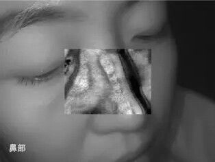 Υπέρυθρος ανιχνευτής εντοπιστών φλεβών Transilluminator οθόνης αφής με 10 χιλ. βάθους απεικόνισης