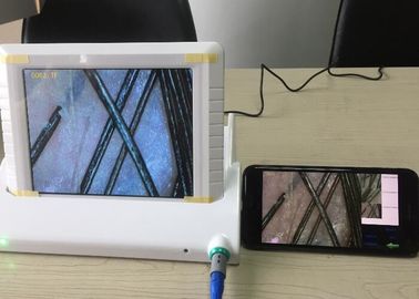 Ψηφιακή συσκευή ανάλυσης δερμάτων Magnifier φορητή τηλεοπτική Dermatoscope με την έκθεση στοιχείων της χρωστικής ουσίας υγρασίας πετρελαίου εύκαμπτης