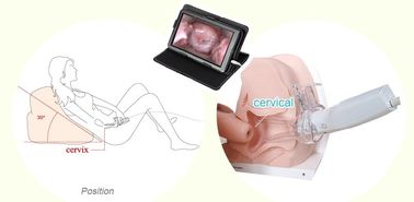 Προϊόν γυναικολογικό ενδοσκοπικό ψηφιακό ηλεκτρονικό Colposcope υγειονομικής περίθαλψης για την εγχώρια χρήση γυναικών