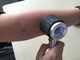 Προσαρμοσμένη υγειονομική περίθαλψη φορητό ιατρικό Dermatoscope για την επιθεώρηση δερμάτων
