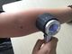 Υψηλή ακρίβεια οπτικό Magnifier 10 φορές δέρμα Analyer Dermatoscope που χρησιμοποιεί τον οπτικό φακό γυαλιού μετάλλων 2 * μπαταριών AA No.5