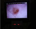 Ψηφιακό τηλεοπτικό οφθαλμοσκόπιο ωτοσκοπίων οργάνων ελέγχου LCD για την κλινική επιθεώρηση του ανθρώπινου σώματος