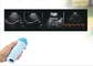 Φορητός σαρωτής κύστης χειρός Micro Convex Probe Υπερηχογράφημα Veterinary Pregnancy