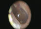 3,5 ίντσας ψηφιακό ωτοσκόπιο επιθεώρησης δερμάτων οθόνης φορητό με το λιμένα μίνι USB αλληλεπίδρασης