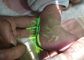 Φλέβα που παρουσιάζει στο σύστημα φορητό υπέρυθρο θεατή φλεβών Transilluminator εντοπιστών ανιχνευτών φλεβών για τα παιδιά