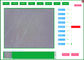 Ψηφιακές Dermatoscope δέρμα τσεπών USB LCD και συσκευή ανάλυσης τρίχας με τη δοκιμή του λογισμικού