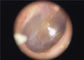 Μίας χρήσης ενδοσκόπιο ωτοσκοπίων καλυμμάτων αυτιών διαθέσιμο ιατρικό φορητό για το λαιμό ματιών αυτιών
