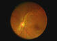 Οφθαλμικό οπτικό εξοπλισμού λαιμού ψηφιακό ενδοσκόπιο Dermatoscope ωτοσκοπίων καμερών τηλεοπτικό με 2 εκατομμύριο εικονοκύτταρα