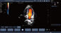Ανιχνευτής υπερήχου Doppler γλωσσικού εμβρυϊκός χρώματος Mutil με το μικροϋπολογιστή - κυρτός έλεγχος