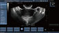 Transvaginal ανιχνευτής υπερήχου Doppler χρώματος ελέγχων, φορητή εγκυμοσύνη Doppler