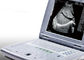 Φορητή μηχανή υπερήχου για το φορητό βάρος ανιχνευτών μόνο 2.2kgs υπερήχου εγκυμοσύνης