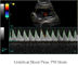 Φορητός ανιχνευτής υπερήχου συστημάτων υπερήχου Doppler χρώματος με όργανο ελέγχου 12,1 οδηγήσεων ίντσας και 2 λιμένες ελέγχων