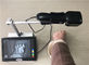 Ιατρικό φορητό βάθος απεικόνισης μηχανών αφαίρεσης φλεβών αραχνών συσκευών εντοπιστών φλεβών &lt; 10mm