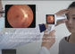 Ψηφιακός εξοπλισμός καμερών βυθών διαγνώσεων ματιών στις ασθένειες βυθών