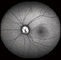Ομοεστιακή αμφιβληστροειδών κάμερα βυθών Opthalmoscope ψηφιακή με FOV 15°, 30°, μέγεθος 1024*1024 εικόνας 60°