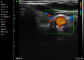 Ipad φορητή υπερήχου ανιχνευτών φορητή χρώματος εφαρμογή γυναικολογίας παιδιατρικής Doppler κοιλιακή αγγειακή