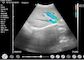 Φορητό διαγνωστικό χέρι υπερήχου εγχώριου Doppler - κρατημένη Doppler εφαρμογή παιδιατρικής γυναικολογίας υπερήχου μαιευτική