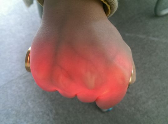 Φορητό αγγειακό προβολέων χρυσό αργίλιο εντοπιστών φλεβών ανιχνευτών φλεβών Venipuncture υπέρυθρο