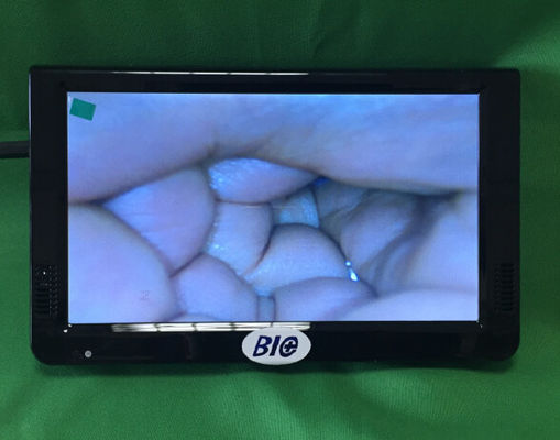 Φορητό Ψηφιακό Ηλεκτρονικό Κολποσκόπιο