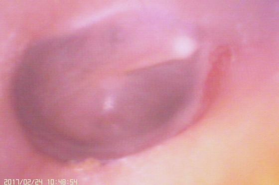 720X480 Ψηφιακό Ωτοσκόπιο