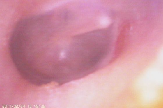 720X480 Ψηφιακό Ωτοσκόπιο