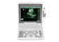 Ψηφιακός φορητός κινητός ιατρικός εξοπλισμός ΒΙΟ 3000J ανιχνευτών υπερήχου lap-top με την οθόνη 1,12 οδηγήσεων ίντσας