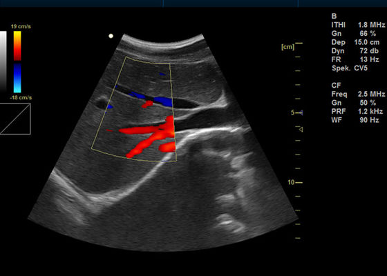 15 ίντσας πλήρης ψηφιακός χρώματος Doppler υπέρηχος απεικόνισης Doppler μηχανών φορητός με το λιμένα 2 USB