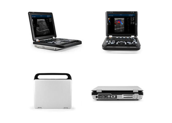 Διαγνωστικός ανθρώπινος ανιχνευτής υπερήχου μηχανών Doppler χρώματος 15 οδηγήσεων ίντσας με τη σύνδεση 2 ελέγχων