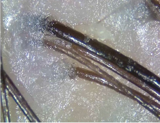 Η φορητή ασύρματη ψηφιακή συσκευή διαγνώσεων τηλεϊατρικής συσκευών ανάλυσης δερμάτων με πολώνει το φως