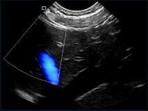 Μίνι τσέπη χειροκίνητο υπερήχων σαρωτή