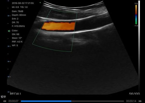 Ψηφιακός Ασύρματος Φορητός Σαρωτής Υπερήχων