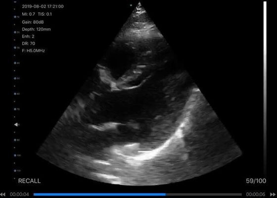Ψηφιακός Ασύρματος Φορητός Σαρωτής Υπερήχων