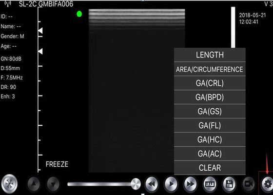 5G φορητός ανιχνευτής υπερήχου κυρτός: 3.5~5MHz, γραμμικά: 7.5~10MHz, καρδιακά: 2.5~5MHz