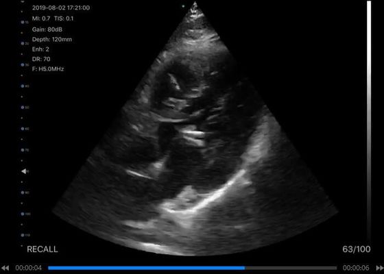 5G φορητός ανιχνευτής υπερήχου κυρτός: 3.5~5MHz, γραμμικά: 7.5~10MHz, καρδιακά: 2.5~5MHz