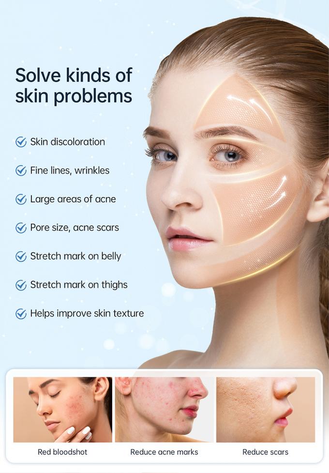 Ηλεκτρική πένα για μικροελέγγια για αναγέννηση κολλαγόνου 9