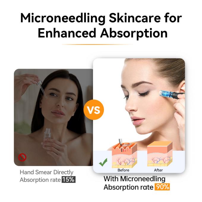 &Alpha;&rho;&chi;&iota;&kappa;ή &mu;ά&rho;&kappa;&alpha; Hydra Pen H5 MicroNeedling Derma Pen &mu;&epsilon; EMS &rho;&upsilon;&theta;&mu;&iota;&zeta;ό&mu;&epsilon;&nu;&eta; έ&xi;&omicron;&delta;&omicron; &omicron;&rho;&omicron;ύ MTS &Mu;&epsilon;&iota;ώ&nu;&epsilon;&iota; &tau;&iota;&sigmaf; &omicron;&upsilon;&lambda;έ&sigmaf; &lambda;&epsilon;&pi;&tau;έ&sigmaf; &gamma;&rho;&alpha;&mu;&mu;έ&sigmaf; &rho;&upsilon;&tau;ί&delta;&epsilon;&sigmaf; 5