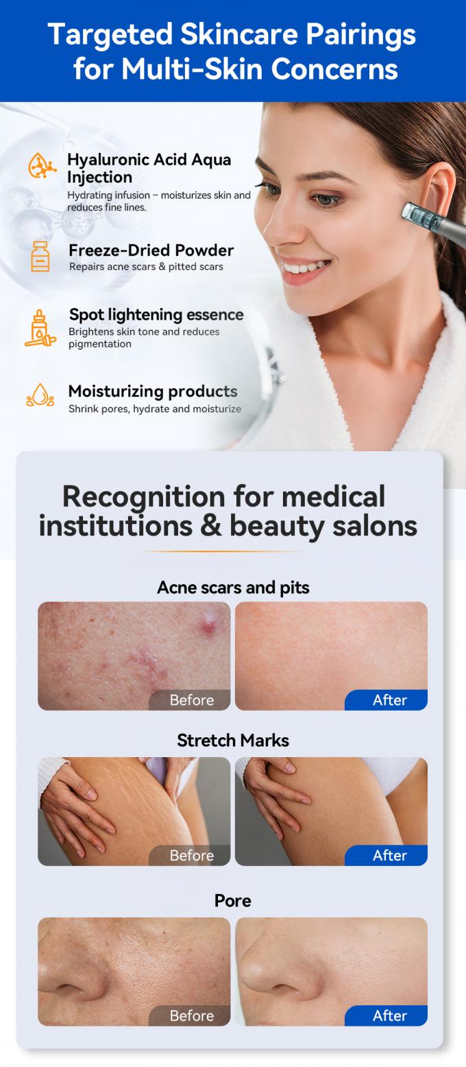 &Alpha;&rho;&chi;&iota;&kappa;ή &mu;ά&rho;&kappa;&alpha; Hydra Pen H5 MicroNeedling Derma Pen &mu;&epsilon; EMS &rho;&upsilon;&theta;&mu;&iota;&zeta;ό&mu;&epsilon;&nu;&eta; έ&xi;&omicron;&delta;&omicron; &omicron;&rho;&omicron;ύ MTS &Mu;&epsilon;&iota;ώ&nu;&epsilon;&iota; &tau;&iota;&sigmaf; &omicron;&upsilon;&lambda;έ&sigmaf; &lambda;&epsilon;&pi;&tau;έ&sigmaf; &gamma;&rho;&alpha;&mu;&mu;έ&sigmaf; &rho;&upsilon;&tau;ί&delta;&epsilon;&sigmaf; 6