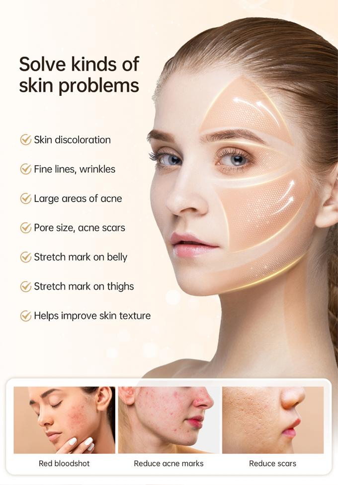 Τελευταίο 4-πολικό EMS Αυτόματο Εφαρμογέα Ορού Hydra Pen H5 Face Skin Derma Microneedling Pen Essence Collagen Regeneration 3